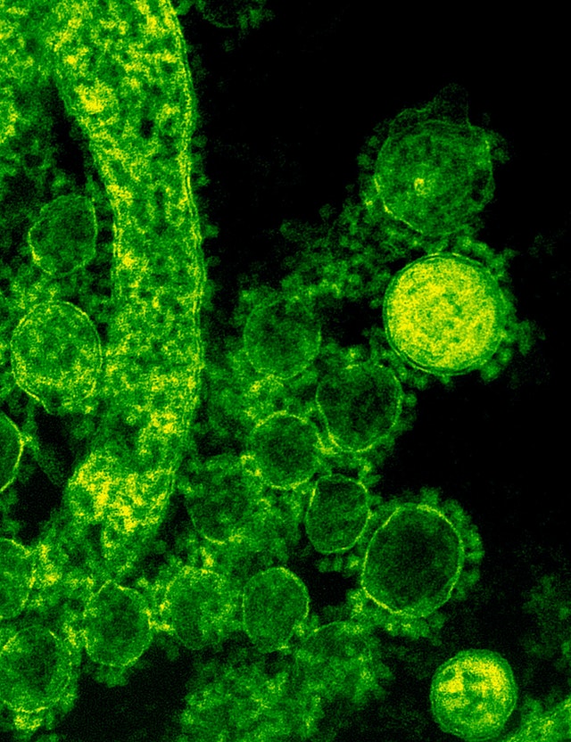 Hongo Candida albicans 1 Hongo Candida albicans