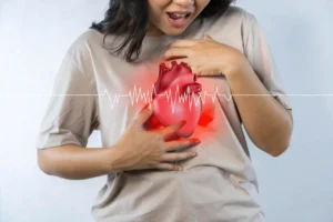 Infarto: causas, síntomas, prevención y señales de alerta que debes conocer